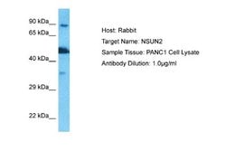 NSUN2 Rabbit anti-Human, Polyclonal, Novus Biologicals 0.1ml; Unconjugated:Antibodies,